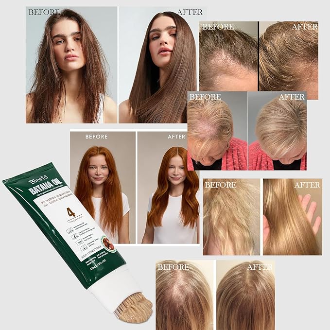Batana Oil for Hair Growth – 100% Pure Organic & Raw Batana – Promotes Thicker, Stronger Hair, Helps Prevent Hair Loss – Natural for Men & Women – 7.76 oz