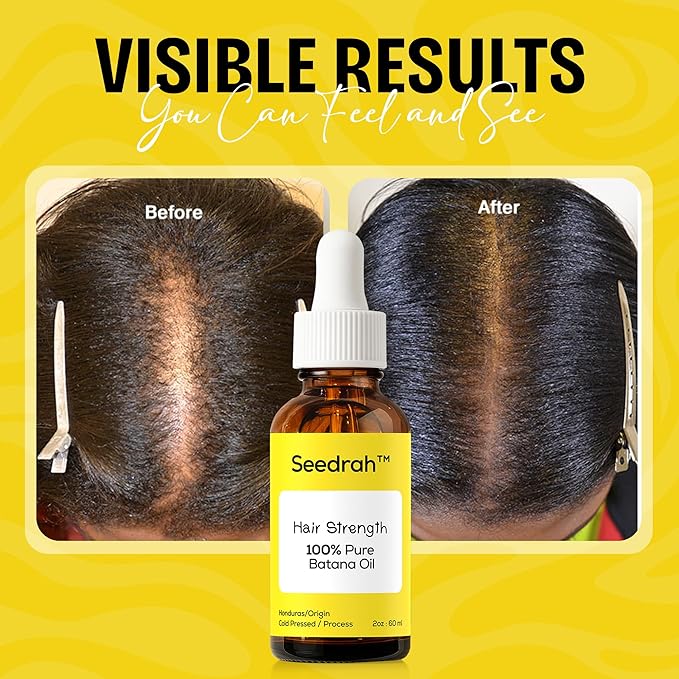 Batana Oil for Hair Growth, 100% Pure & natural Batana Oil from Honduras, helps Prevent Hair Loss, Eliminate Split Ends for Men & Women|For All Hair Types - 2 fl oz