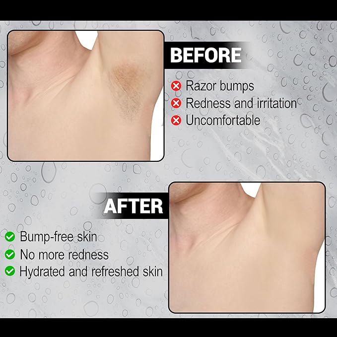 Xotics Skin Rescue Razor Bump 2oz - All Natural Barber Aftershave Razor Burn Treatment for Men/Women - All Natural Ingredients