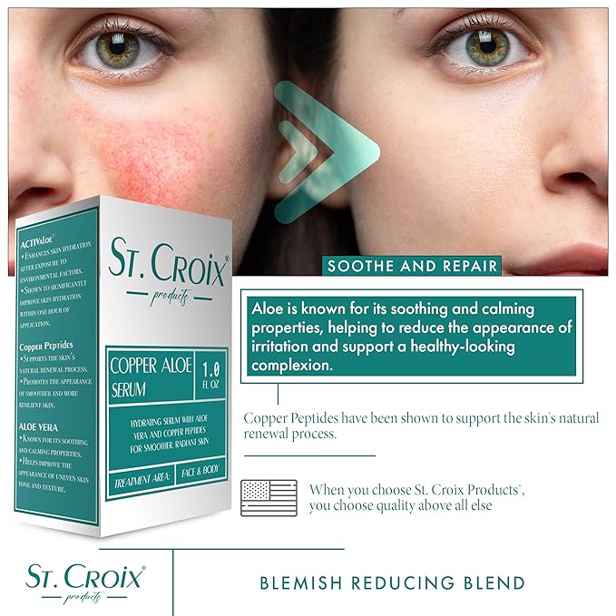Copper Peptide & Aloe Serum – Hydrates, Firms & Soothes Skin – Highest-Grade 0.25% Copper with Pure Aloe Vera 10X-D – 1 fl oz – Peptide Blast by St. Croix Products
