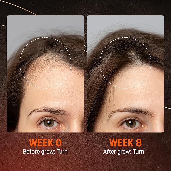 Abera Hair Growth Serum for Hair Loss, Natural Hair Regrowth Treatment for Hair & Beard with Biotin & Castor Oil, (2 Serum + Gift)
