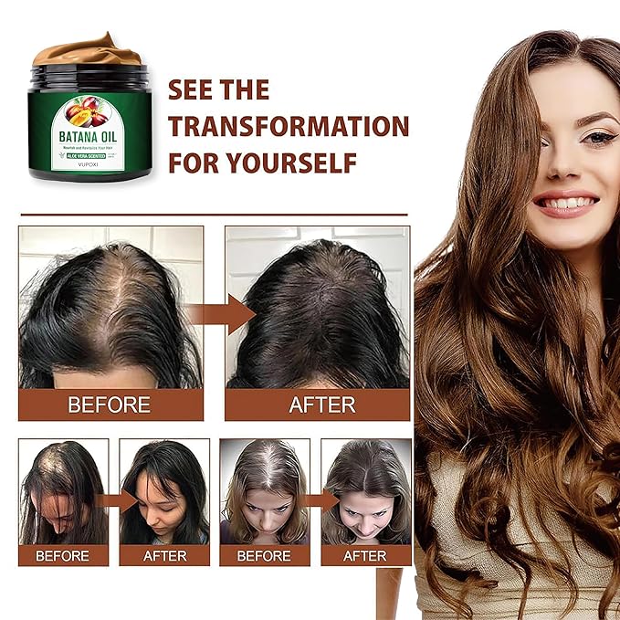 Batana Oil for Hair Growth - Dr. Sebi Pure batana oil from Honduras - Unrefined Raw hair oil Prevents Hair Loss - Promotes Hair Thickness - 100% Natural Organic - 7.7 Fl OZ