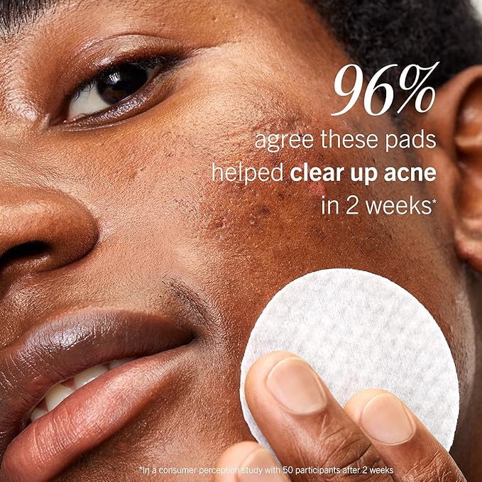 First Aid Beauty Acne Pads for Face - Maximum Strength Acne Treatment - 2% Salicylic Acid Pads Treat Without Drying, (60-ct)