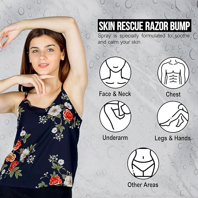 Xotics Skin Rescue Razor Bump 2oz - All Natural Barber Aftershave Razor Burn Treatment for Men/Women - All Natural Ingredients