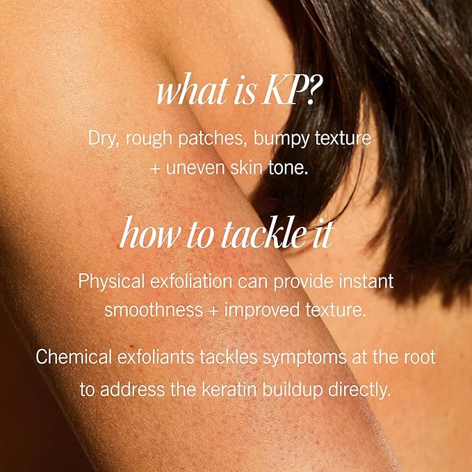 First Aid Beauty Smooth + Juicy Body Scrub Kit: KP Bump Eraser Body Scrub with 10% AHA, Daily Exfoliation Keratosis Pilaris Set to Help Reduce Chicken Skin Bumps; Strawberry, Peach, & Original (2 oz)
