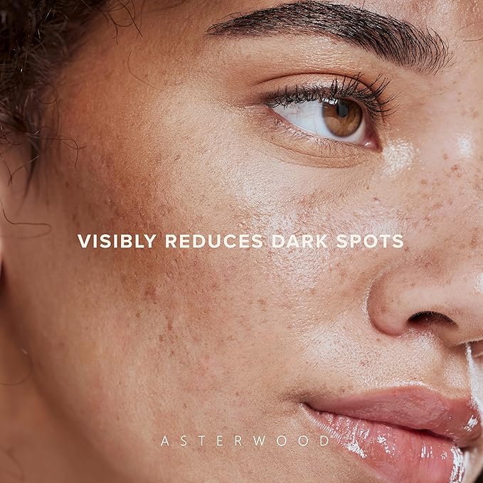 Asterwood Dark Spot Corrector for Face Serum - with Radianskin - with Tranexamic Acid, Kojic Acid, Glycolic Acid, & Salicylic Acid - 1 Fl Oz