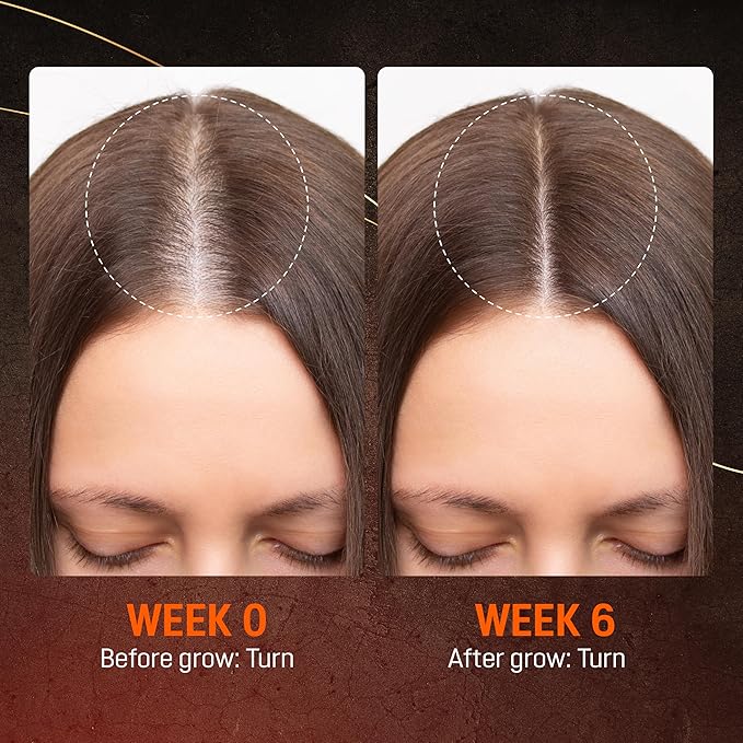 Abera Hair Growth Serum for Hair Loss, Natural Hair Regrowth Treatment for Hair & Beard with Biotin & Castor Oil, (2 Serum + Gift)
